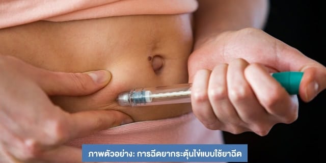 รักษาด้วยวิธี IUI Beyond ivf มีลูกยากอยากมีลูก มีลูกแฝด ทำกิ๊ฟท์ IVF IUI ICSI ศูนย์รักษามีบุตรยาก