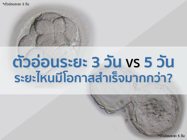 ตัวอ่อนระยะ 3 วัน VS 5 วัน ระยะไหนมีโอกาสสำเร็จมากกว่า beyond ivf หมอต้น พูนศักดิ์