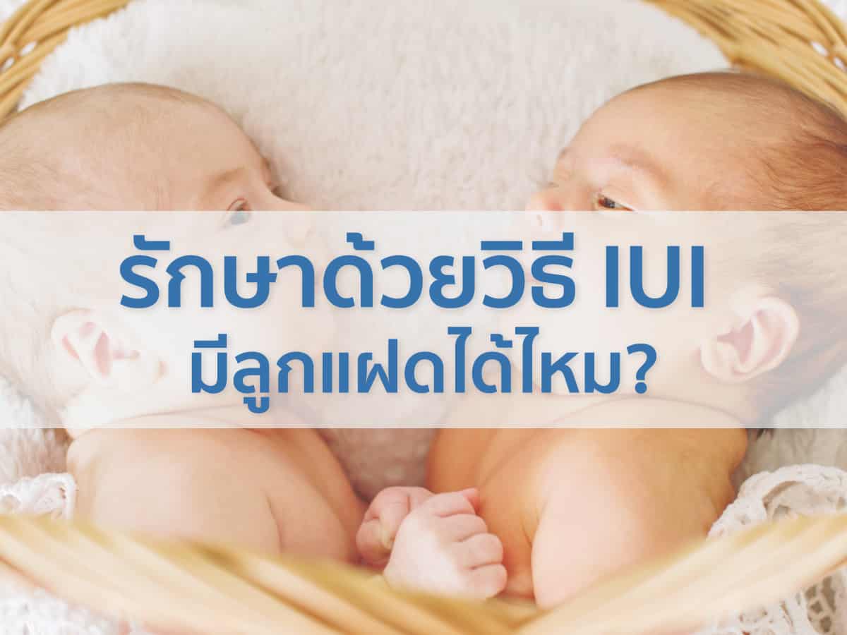 รักษาด้วยวิธี-IUI-ลูกแฝดได้ไหม