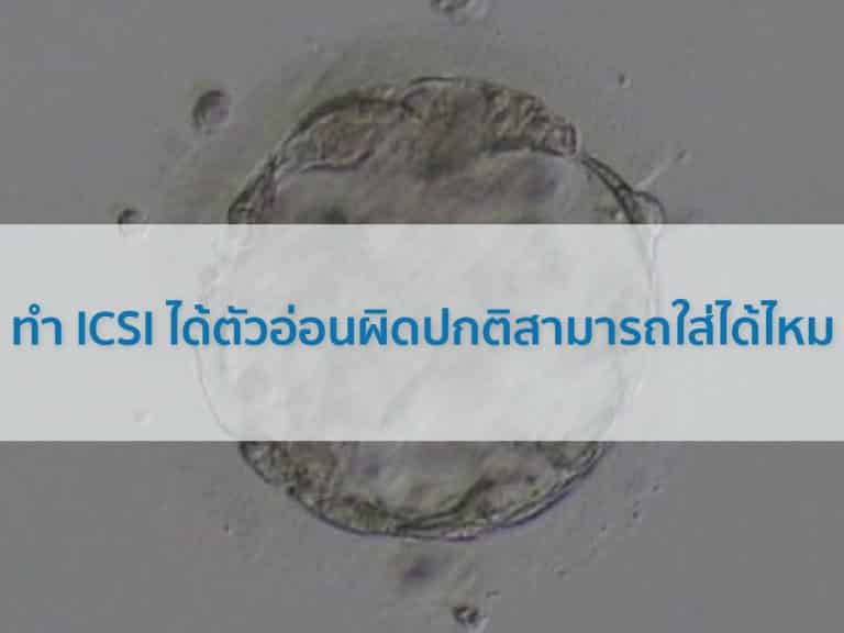 ตัวอ่อนผิดปกติ ทำ ICSI ได้ตัวอ่อนผิดปกติสามารถใส่ได้ไหม Beyond IVF