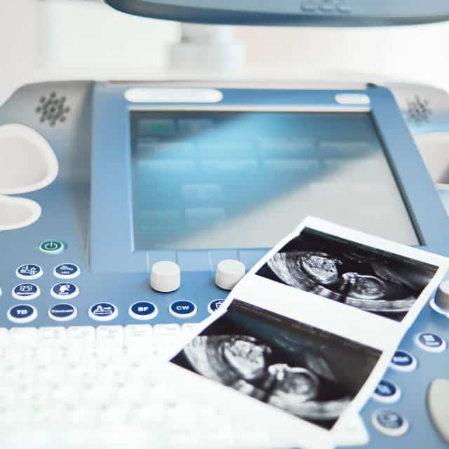 ตรวจครรภ์-ตรวจครรภ์สำหรับคุณแม่-ฝากครรภ์-Beyond-IVF