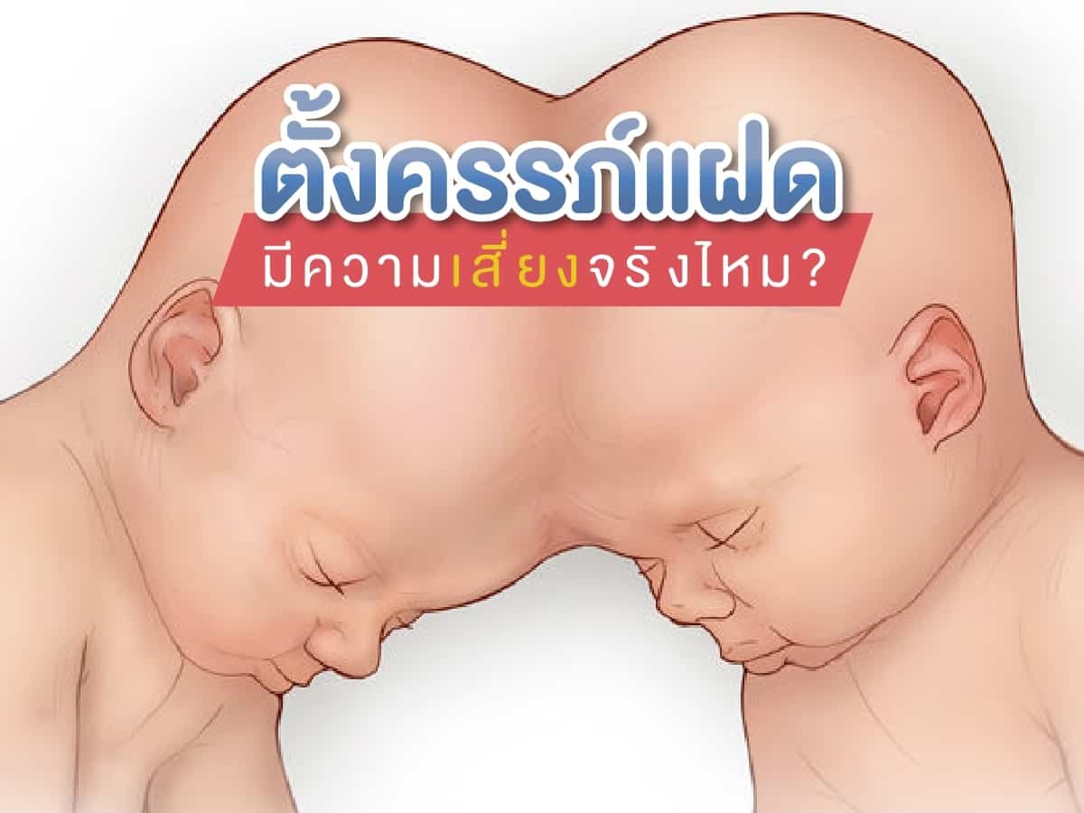 ตั้งครรภ์แฝดมีความเสี่ยงจริงไหม ตั้งครรภ์แฝด ท้องแฝด Beyond IVF