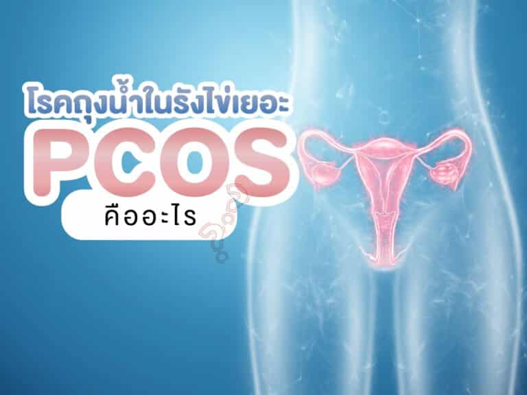 โรคถุงน้ำในรังไข่หลายใบ หรือ PCOS คืออะไร Beyond IVF