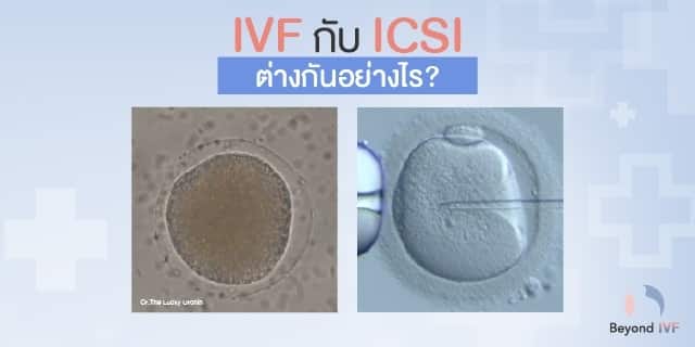 IVF ICSI ต่างกันอย่างไร เด็กหลอดแก้ว Beyond IVF