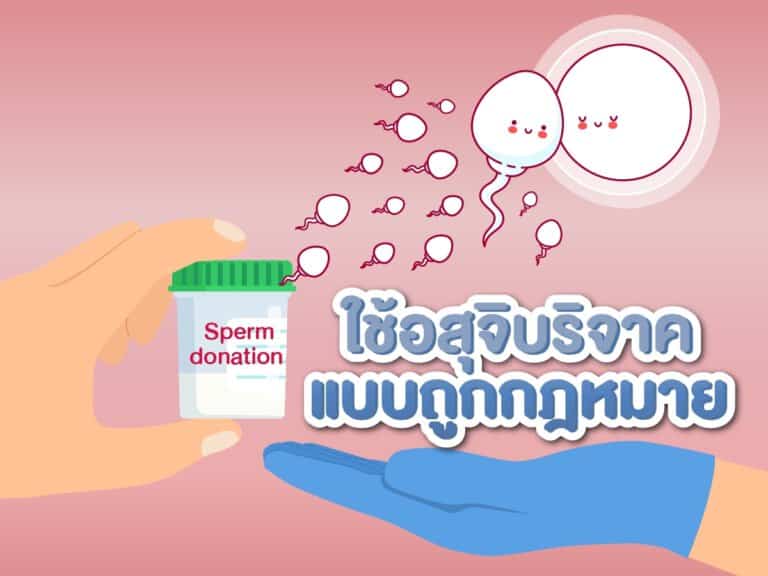 อสุจิบริจาค ถูกกฎหมาย อสุจิ Beyond IVF