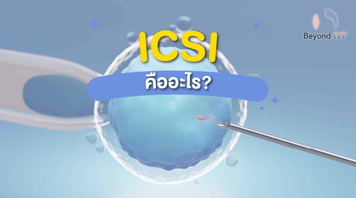 ICSI คืออะไร
