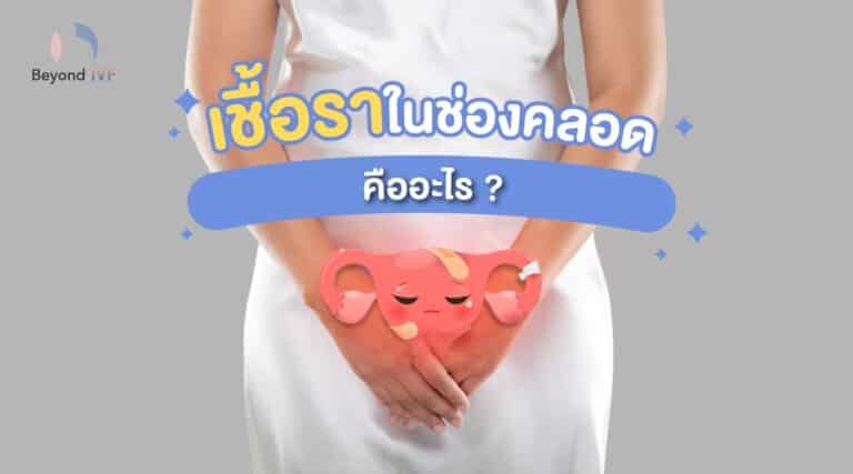 เชื้อราในช่องคลอด