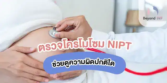 ตรวจโครโมโซม NIPT 