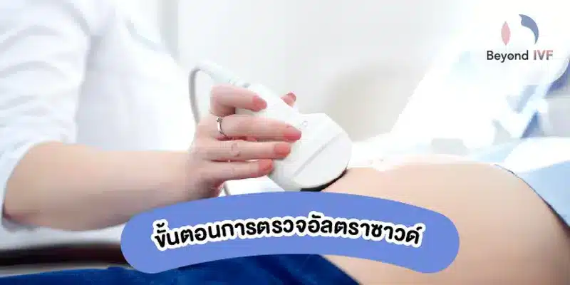 ขั้นตอนการตรวจอัลตร้าซาวด์