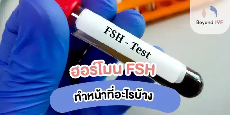 fsh คือ