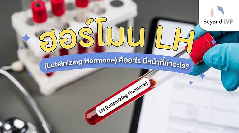 Luteinizing Hormone