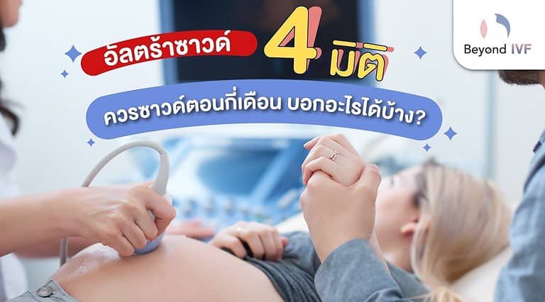 อัลตร้าซาวด์ 4 มิติ