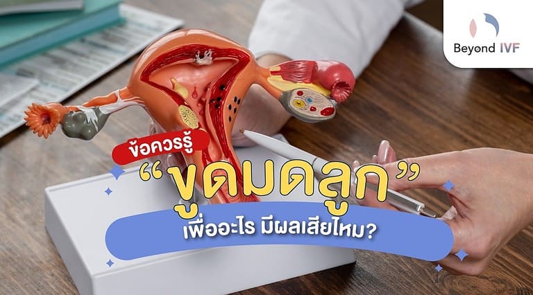 ขูดมดลูก