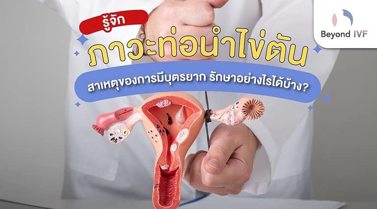 ท่อนำไข่อุดตัน