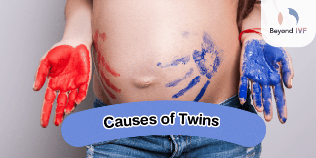 Causes of Twins