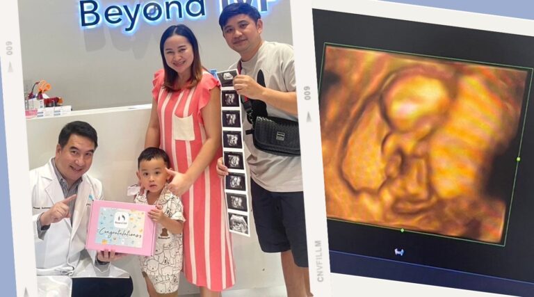 ICSI-รีวิวICSI-ตั้งครรภ์สำเร็จ-มีลูกยาก-หมอต้น พูนศักดิ์ Beyond IVF