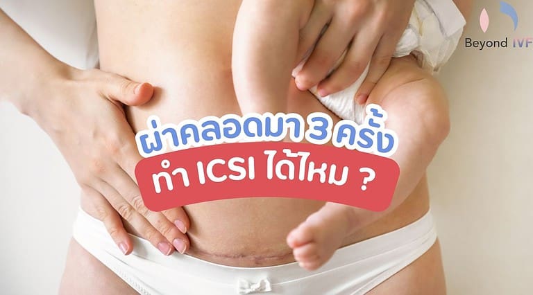 ผ่าคลอดมา 3 ครั้งสามารถทำ ICSI ได้ไหม ? ตอบคำถามโดย คุณหมอกิตติ ฉัตรตระกูลชัย