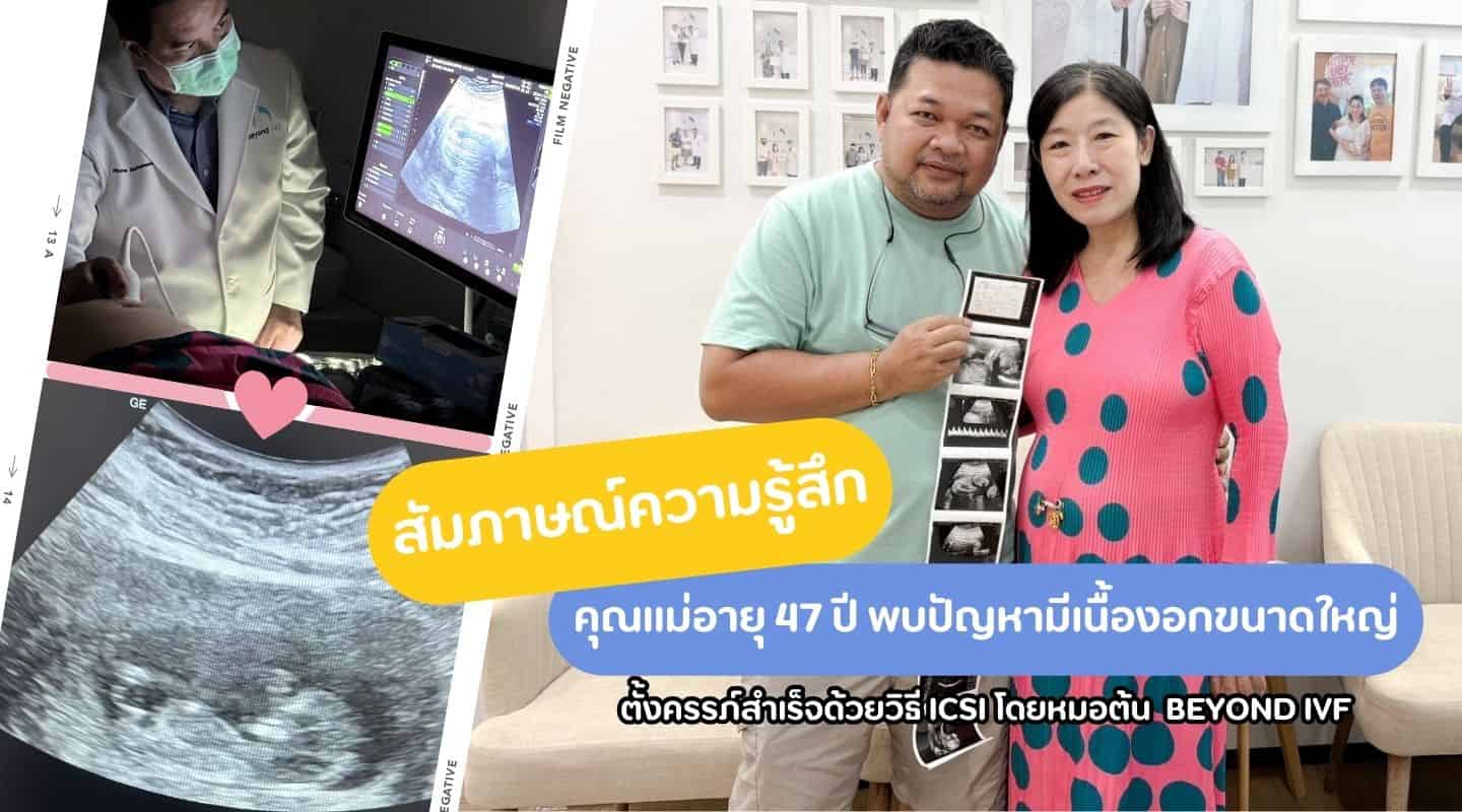 สัมภาษณ์คุณแม่วัย 47 ตั้งครรภ์ได้สำเร็จด้วยวิธีการ ICSI โดยคุณหมอต้น ที่ Beyond IVF